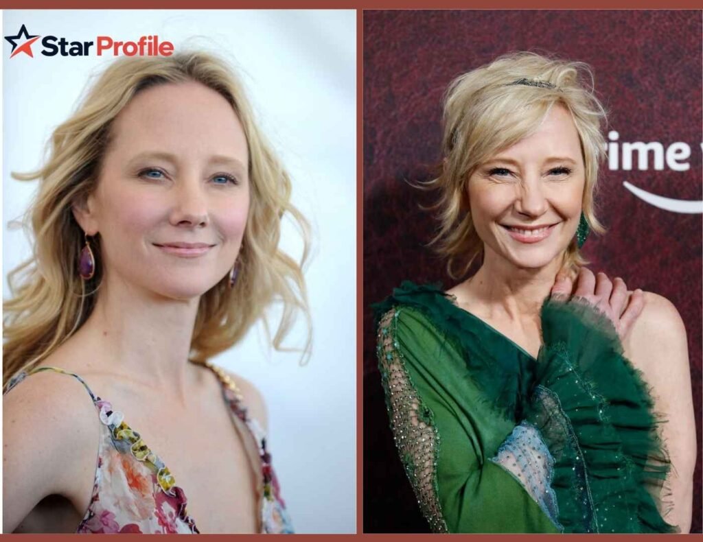 Anne Heche Accident