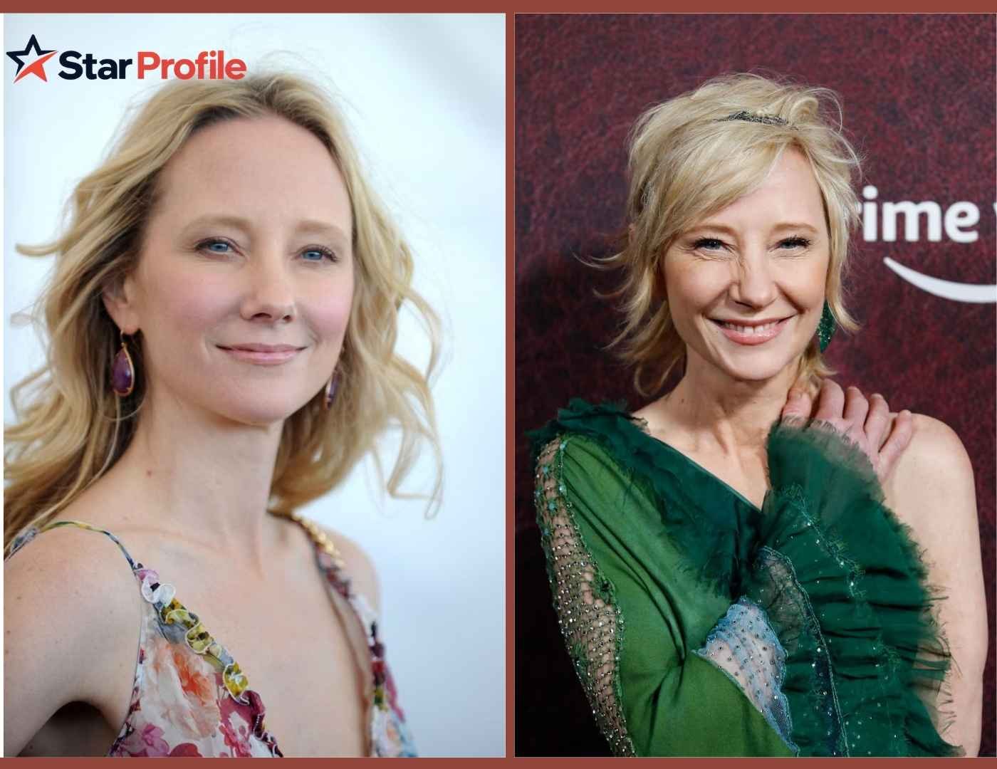 Anne Heche Accident
